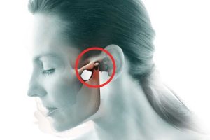 Temporomandibular Joint Disorders in Dentistry